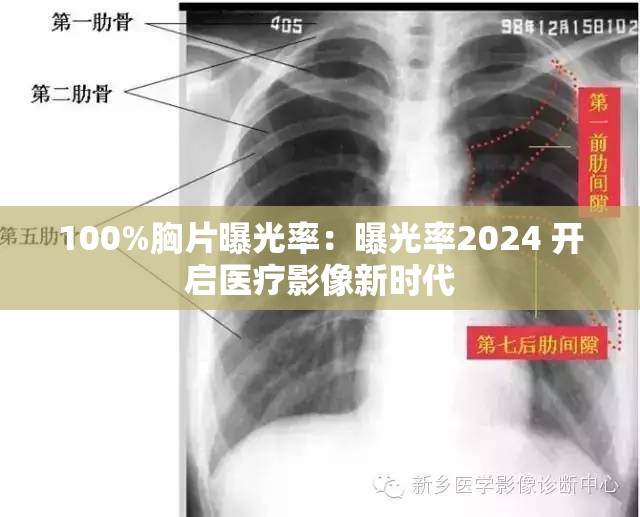 100%胸片曝光率：曝光率2024 开启医疗影像新时代