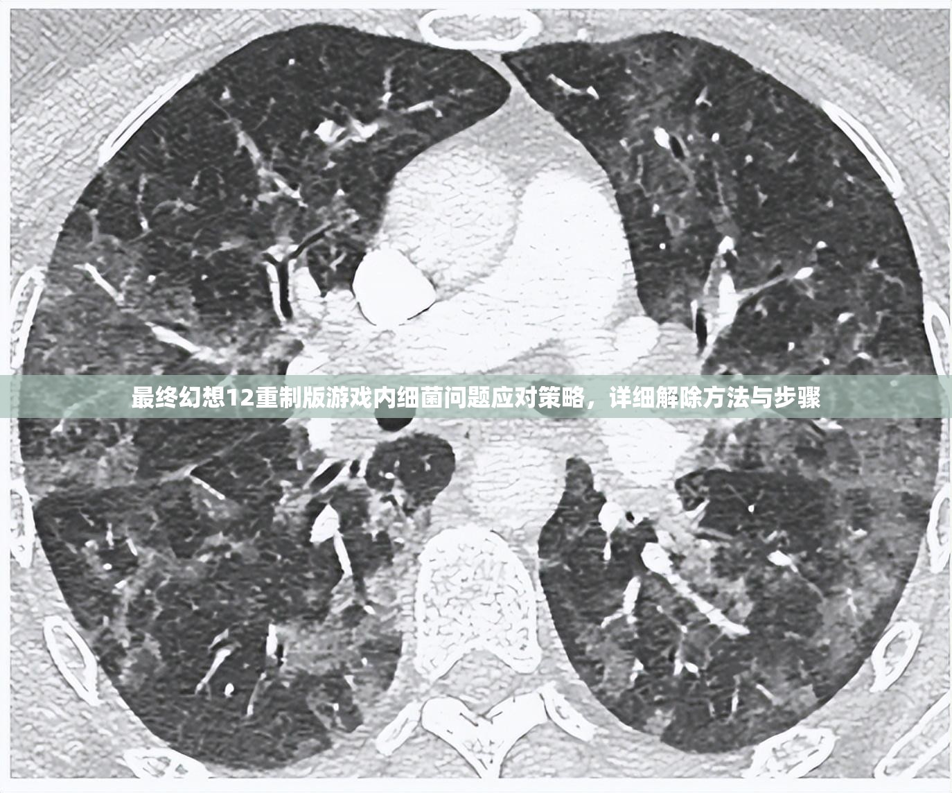 最终幻想12重制版游戏内细菌问题应对策略，详细解除方法与步骤