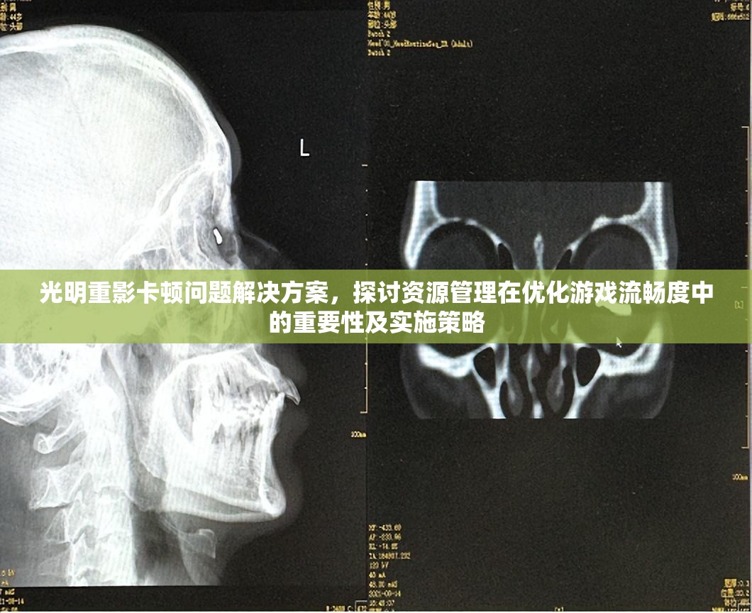 光明重影卡顿问题解决方案，探讨资源管理在优化游戏流畅度中的重要性及实施策略